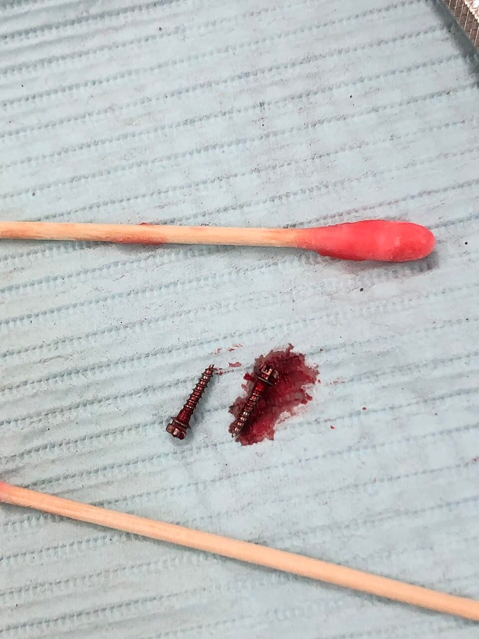 Removed anchorage screws